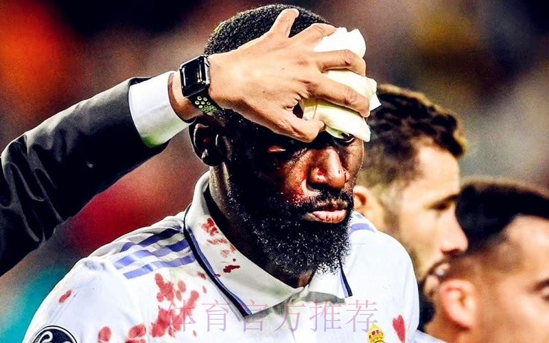 欧冠-吕迪格95分钟绝平+血染赛场!皇马1-1提前出线